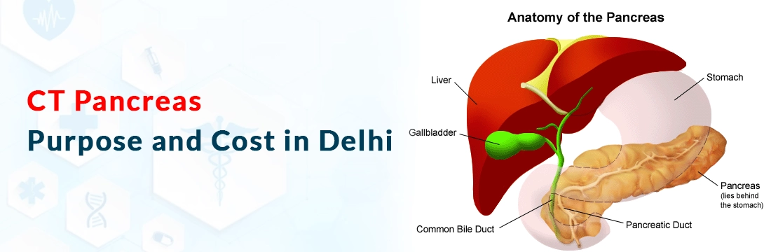  CT Pancreas: Purpose and cost in Delhi